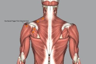 What are muscle knots? An exercise physiologist explains what those tight little lumps are and how to get rid of them…